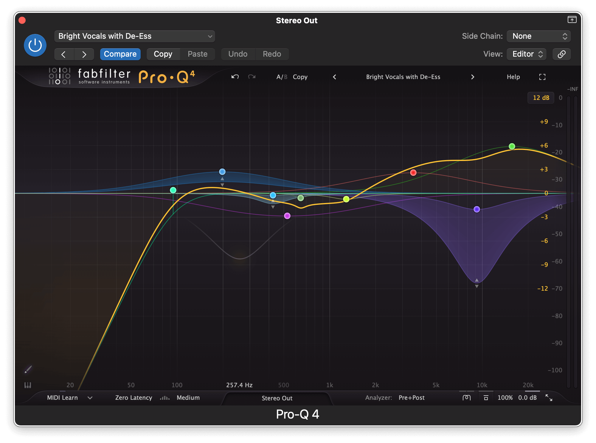 什麼是 Dynamic EQ? deeaser